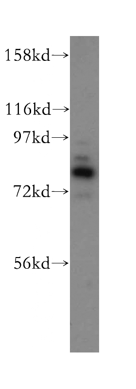 HeLa cells were subjected to SDS PAGE followed by western blot with Catalog No:107908(AFG3L2 antibody) at dilution of 1:800
