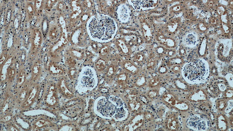 Immunohistochemical of paraffin-embedded human kidney using Catalog No:113540(P21 antibody) at dilution of 1:50 (under 10x lens)