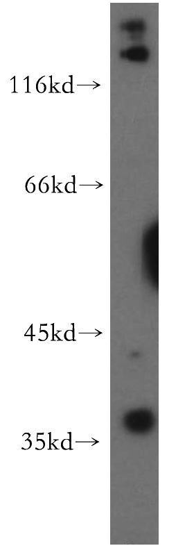 HeLa cells were subjected to SDS PAGE followed by western blot with Catalog No:116285(TNFAIP1 antibody) at dilution of 1:500