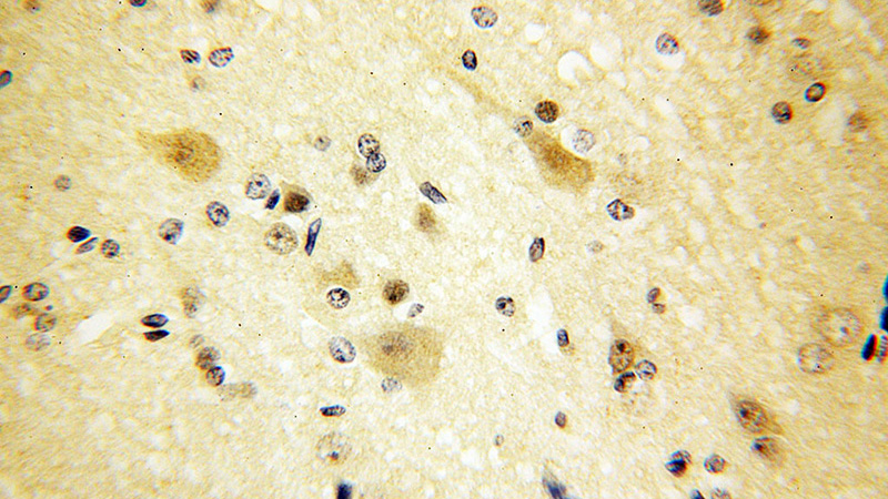 Immunohistochemical of paraffin-embedded human brain using Catalog No:113353(NudCL antibody) at dilution of 1:100 (under 40x lens)