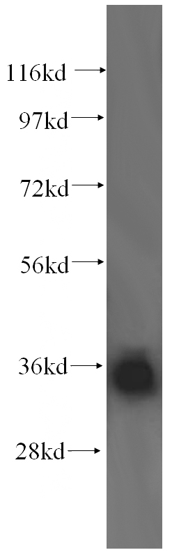 human testis tissue were subjected to SDS PAGE followed by western blot with Catalog No:112419(LZTFL1 antibody) at dilution of 1:500