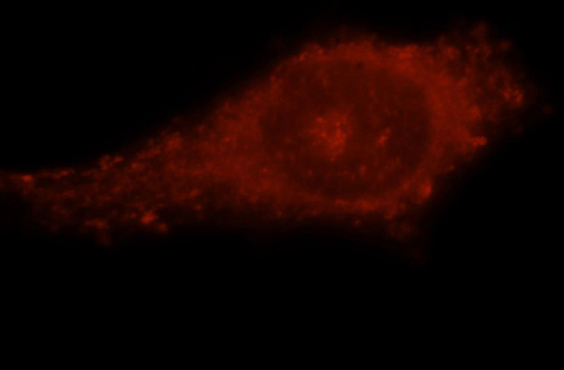 Immunofluorescent analysis of MCF-7 cells, using COPS3 antibody Catalog No:109463 at 1:25 dilution and Rhodamine-labeled goat anti-rabbit IgG (red).
