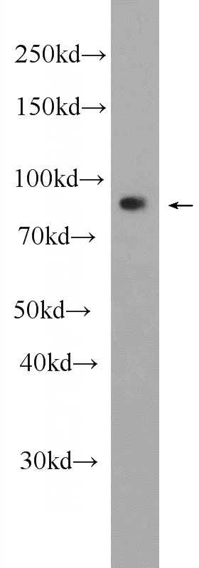 HeLa cells were subjected to SDS PAGE followed by western blot with Catalog No:112314(LRCH1 Antibody) at dilution of 1:1000