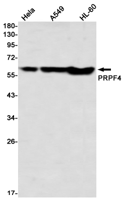 Western blot detection of PRPF4 in Hela,A549,HL-60 using PRPF4 Rabbit mAb(1:1000 diluted)