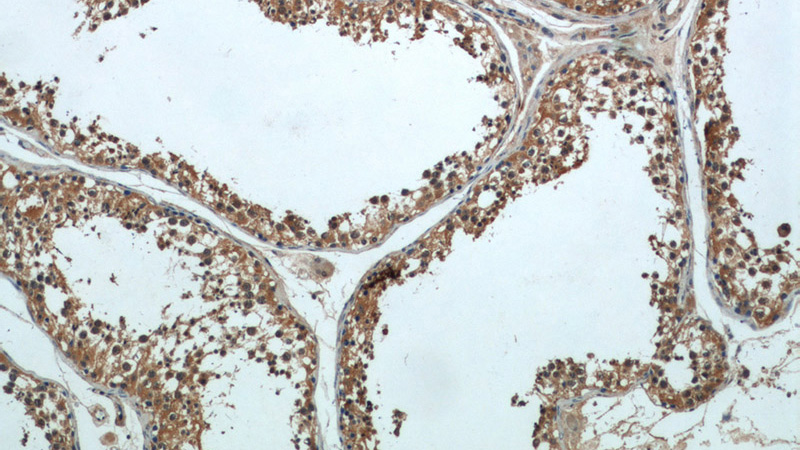Immunohistochemical of paraffin-embedded human testis using Catalog No:113434(OSBPL9 antibody) at dilution of 1:50 (under 10x lens)