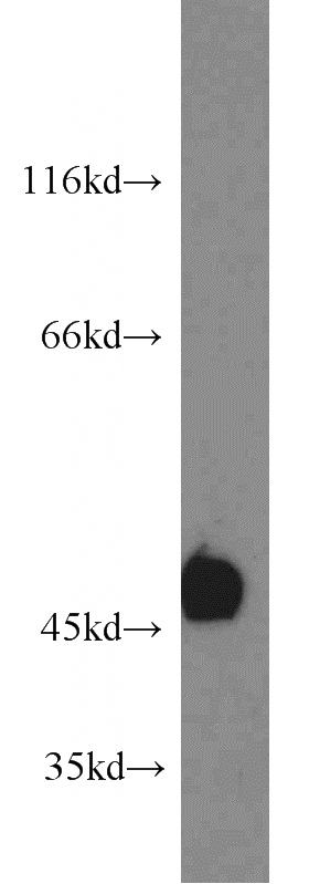 Jurkat cells were subjected to SDS PAGE followed by western blot with Catalog No:109238(CHN1 antibody) at dilution of 1:1500