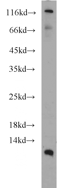 MCF7 cells were subjected to SDS PAGE followed by western blot with Catalog No:110007(DMRTC1B antibody) at dilution of 1:500