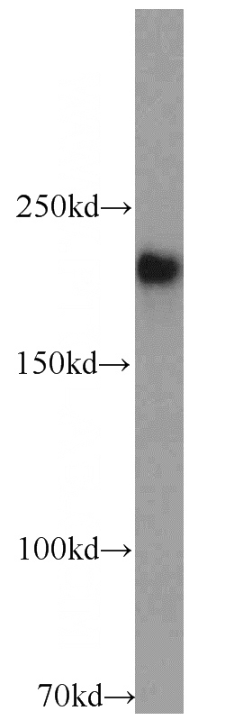 HEK-293 cells were subjected to SDS PAGE followed by western blot with Catalog No:114490(RB1CC1 antibody) at dilution of 1:1000