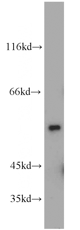 HeLa cells were subjected to SDS PAGE followed by western blot with Catalog No:109891(DEPDC6 antibody) at dilution of 1:500
