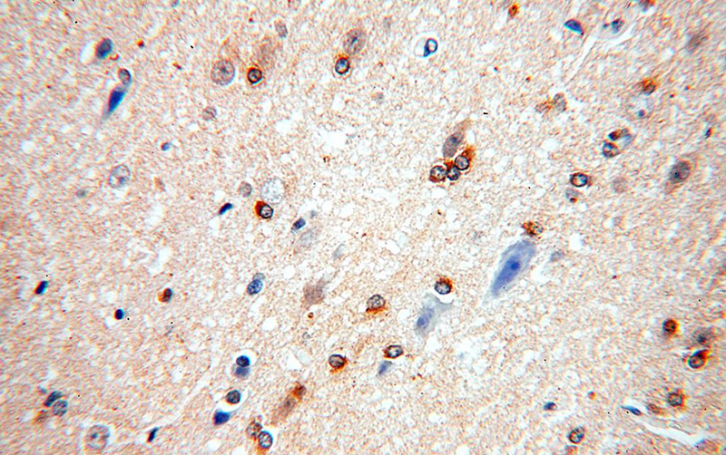 Immunohistochemical of paraffin-embedded human brain using Catalog No:108287(ATF6B antibody) at dilution of 1:100 (under 40x lens)