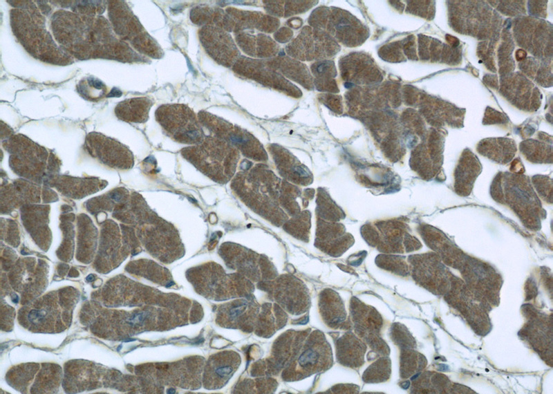 Immunohistochemistry of paraffin-embedded human heart tissue slide using Catalog No:111985(KIAA0774 Antibody) at dilution of 1:50 (under 10x lens)