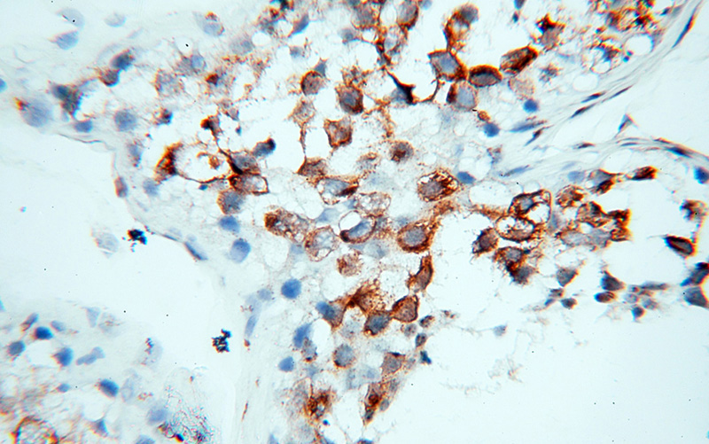 Immunohistochemical of paraffin-embedded human testis using Catalog No:111014(GOLGA2,GM130 antibody) at dilution of 1:100 (under 40x lens)
