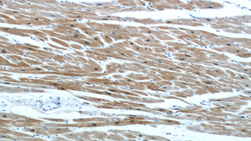 Immunohistochemical of paraffin-embedded human heart using Catalog No:109610(CSRP3 antibody) at dilution of 1:50 (under 10x lens)