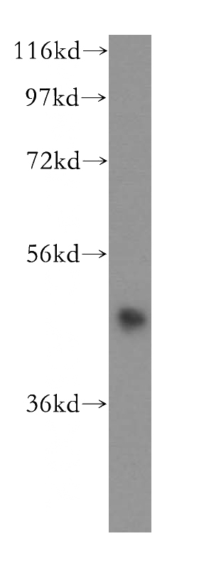 HeLa cells were subjected to SDS PAGE followed by western blot with Catalog No:111383(HDAC8 antibody) at dilution of 1:500