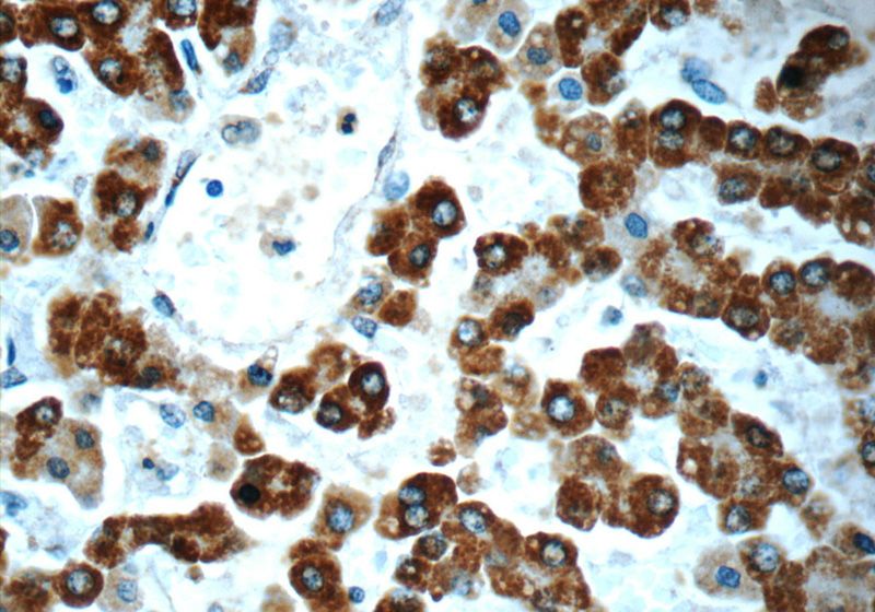 Immunohistochemistry of paraffin-embedded human liver slide using Catalog No:107565(AK2 Antibody) at dilution of 1:50
