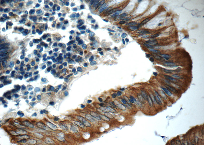 Immunohistochemistry of paraffin-embedded human colon tissue slide using Catalog No:109805(KRT20 Antibody) at dilution of 1:50 (under 40x lens)