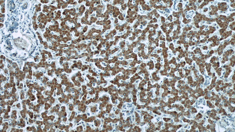 Immunohistochemical of paraffin-embedded human liver using Catalog No:110445(F12 antibody) at dilution of 1:50 (under 10x lens)