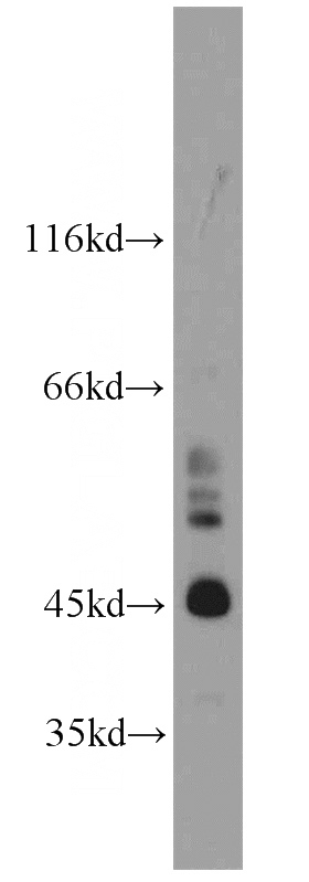 mouse testis tissue were subjected to SDS PAGE followed by western blot with Catalog No:115564(SPERT antibody) at dilution of 1:1000