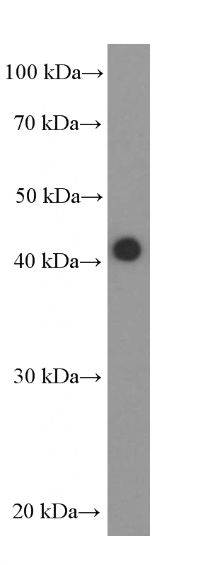 HEK-293 cells were subjected to SDS PAGE followed by western blot with Catalog No:107338(NR2F6 Antibody) at dilution of 1:2000