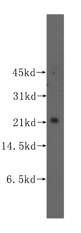 human thyroid gland tissue were subjected to SDS PAGE followed by western blot with Catalog No:116522(UBE2E2 antibody) at dilution of 1:300