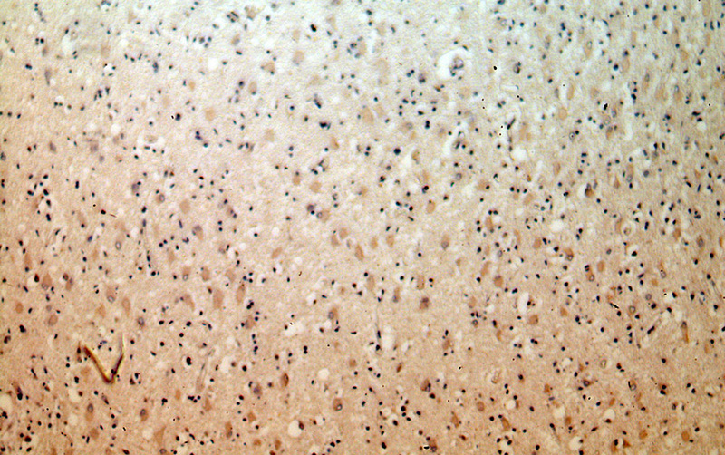 Immunohistochemical of paraffin-embedded human brain using Catalog No:114209(PRMT8 antibody) at dilution of 1:50 (under 10x lens)