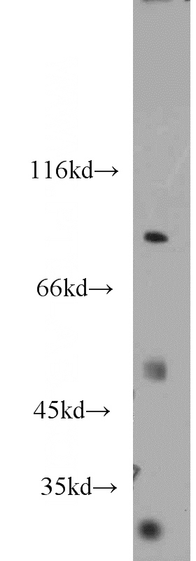 mouse testis tissue were subjected to SDS PAGE followed by western blot with Catalog No:111644(IKBKB antibody) at dilution of 1:600