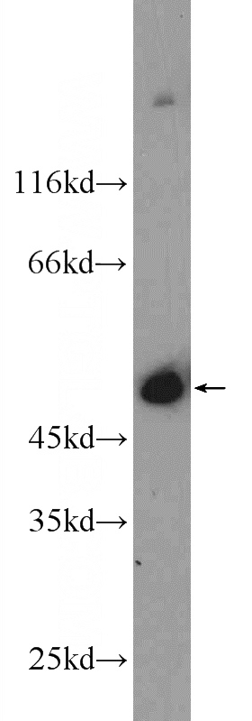 mouse heart tissue were subjected to SDS PAGE followed by western blot with Catalog No:112899(MURC Antibody) at dilution of 1:600
