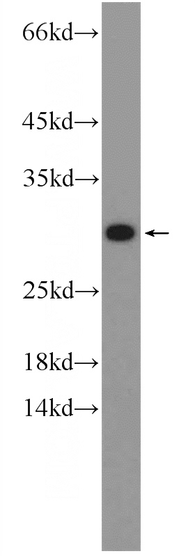 HepG2 cells were subjected to SDS PAGE followed by western blot with Catalog No:108699(C20orf20 Antibody) at dilution of 1:600