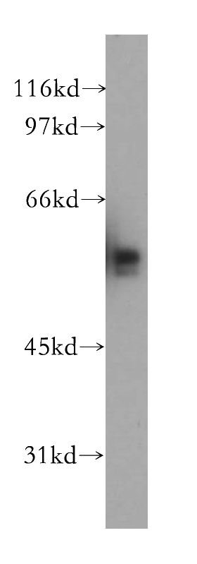 Jurkat cells were subjected to SDS PAGE followed by western blot with Catalog No:115989(TAF7 antibody) at dilution of 1:500