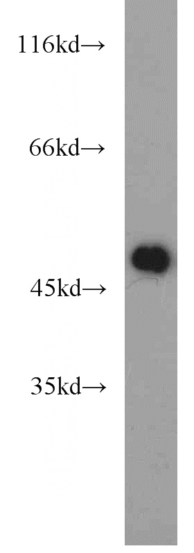 mouse brain tissue were subjected to SDS PAGE followed by western blot with Catalog No:116963(ZNF238 antibody) at dilution of 1:1000