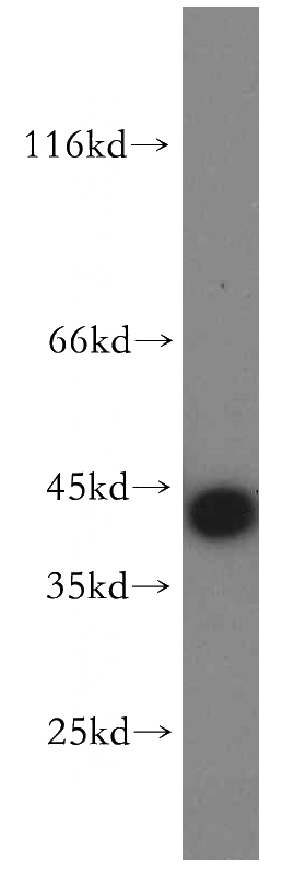 HEK-293 cells were subjected to SDS PAGE followed by western blot with Catalog No:112486(MAS1L-Specific antibody) at dilution of 1:500