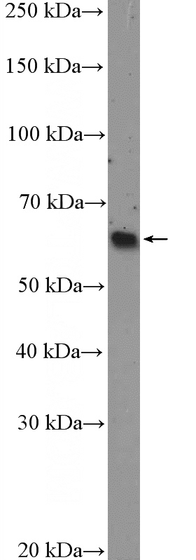 Jurkat cells were subjected to SDS PAGE followed by western blot with Catalog No:113554(CDKN1C Antibody) at dilution of 1:600