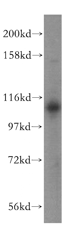 HepG2 cells were subjected to SDS PAGE followed by western blot with Catalog No:116598(USP20 antibody) at dilution of 1:400