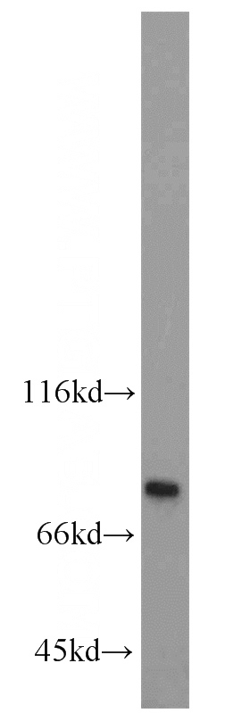 HEK-293 cells were subjected to SDS PAGE followed by western blot with Catalog No:114799(RPAP3 antibody) at dilution of 1:1000