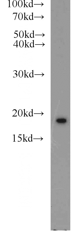 HeLa cells were subjected to SDS PAGE followed by western blot with Catalog No:113246(NME1 antibody) at dilution of 1:1500