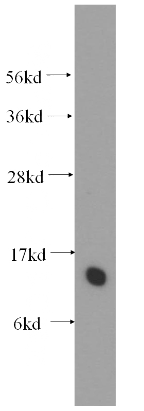 human liver tissue were subjected to SDS PAGE followed by western blot with Catalog No:115899(TCEAL7 antibody) at dilution of 1:500
