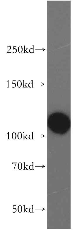 HeLa cells were subjected to SDS PAGE followed by western blot with Catalog No:109568(XPO1 antibody) at dilution of 1:500