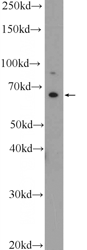 K-562 cells were subjected to SDS PAGE followed by western blot with Catalog No:111774(IL1RL2 Antibody) at dilution of 1:300