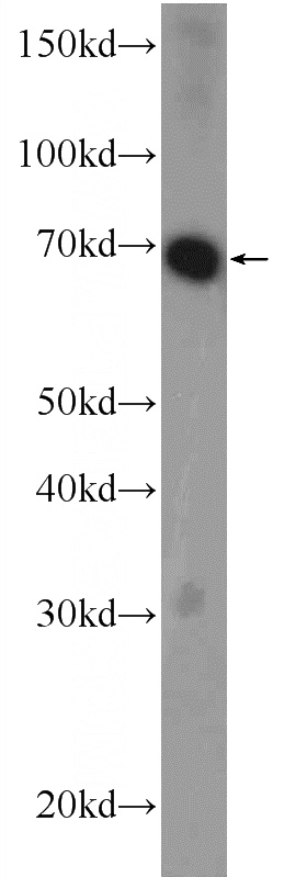 mouse brain tissue were subjected to SDS PAGE followed by western blot with Catalog No:114582(RCOR3 Antibody) at dilution of 1:600