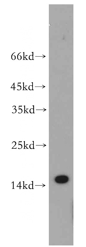 Raji cells were subjected to SDS PAGE followed by western blot with Catalog No:115911(TCL1A antibody) at dilution of 1:300