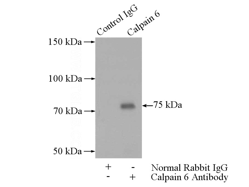 IP Result of anti-CAPN6 (IP:Catalog No:108836, 4ug; Detection:Catalog No:108836 1:300) with human placenta tissue lysate 1520ug.