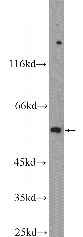 HeLa cells were subjected to SDS PAGE followed by western blot with Catalog No:115886(TBX15 Antibody) at dilution of 1:600