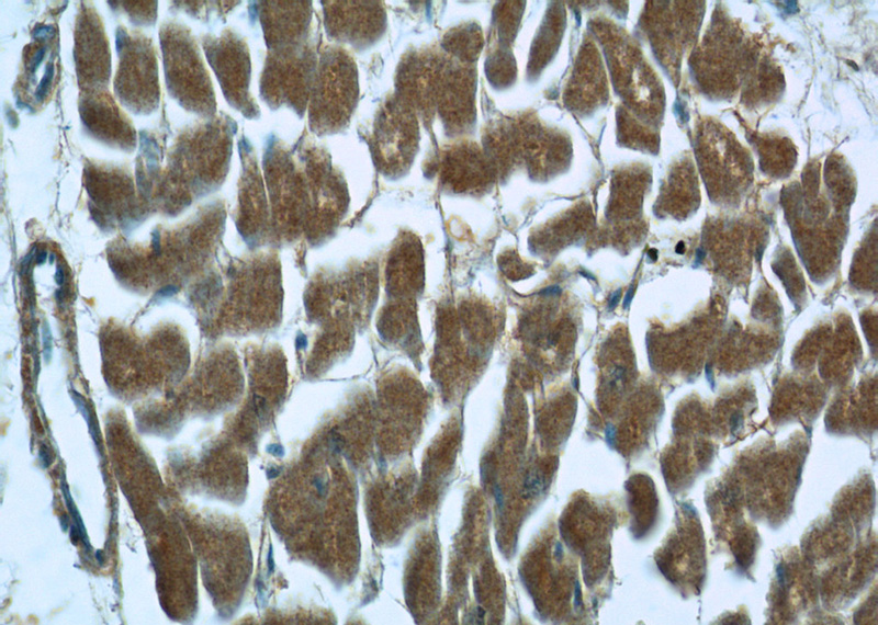 Immunohistochemistry of paraffin-embedded human heart tissue slide using Catalog No:114081(PPARG Antibody) at dilution of 1:50 (under 40x lens)