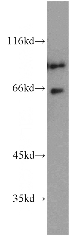 human brain tissue were subjected to SDS PAGE followed by western blot with Catalog No:114978(SATB2 antibody) at dilution of 1:1000