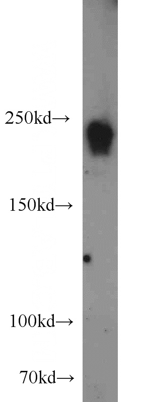 Jurkat cells were subjected to SDS PAGE followed by western blot with Catalog No:112144(LARG antibody) at dilution of 1:2000