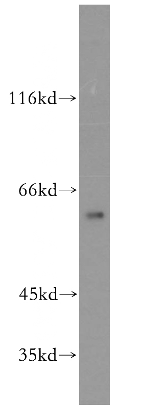 mouse brain tissue were subjected to SDS PAGE followed by western blot with Catalog No:109518(CPNE6 antibody) at dilution of 1:500