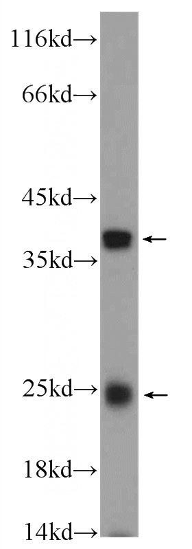 mouse colon tissue were subjected to SDS PAGE followed by western blot with Catalog No:116201(TMEM9B Antibody) at dilution of 1:600