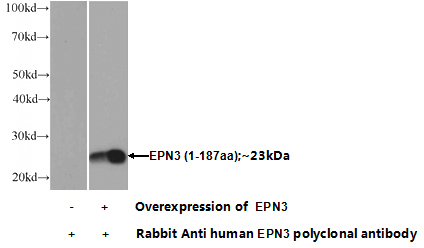 Transfected HEK-293 cells were subjected to SDS PAGE followed by western blot with Catalog No:110389(EPN3 Antibody) at dilution of 1:1000