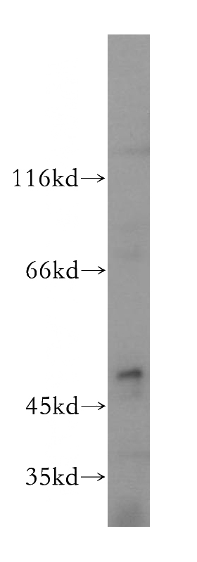 PC-3 cells were subjected to SDS PAGE followed by western blot with Catalog No:116021(TGFB3 antibody) at dilution of 1:500