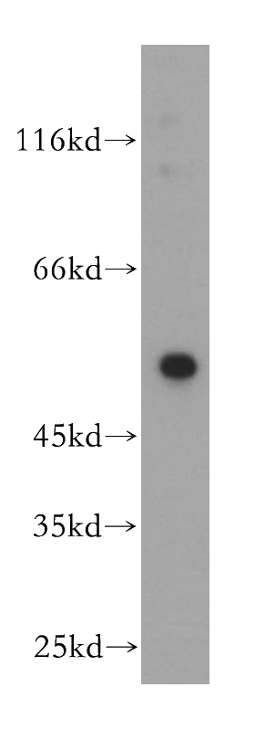 human heart tissue were subjected to SDS PAGE followed by western blot with Catalog No:108910(CASQ2 antibody) at dilution of 1:500